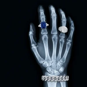 Edgy luxury jewelry X-ray concept